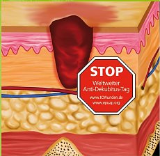 Wundsymposium (Adobe Stock)