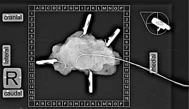 Präparateradiografie nach Drahtmarkierung (Foto: SHK)