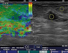 Elastografieanalyse (Foto: SHK)