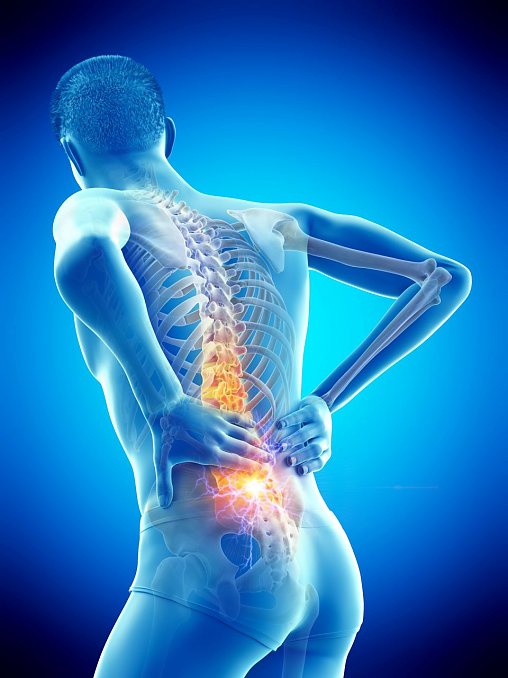 Neue Möglichkeiten der Behandlung von Rückenschmerzen  (Foto: AdobeStock_266550171)