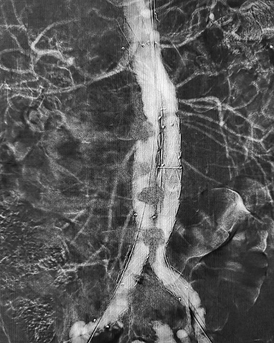 Kontrastmittelfreie Angiografie (Foto: SHK | Markus Batereau)