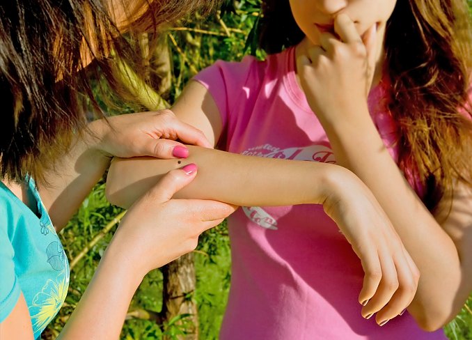 Zeckenbiss (Foto: AdobeStock_52213841)