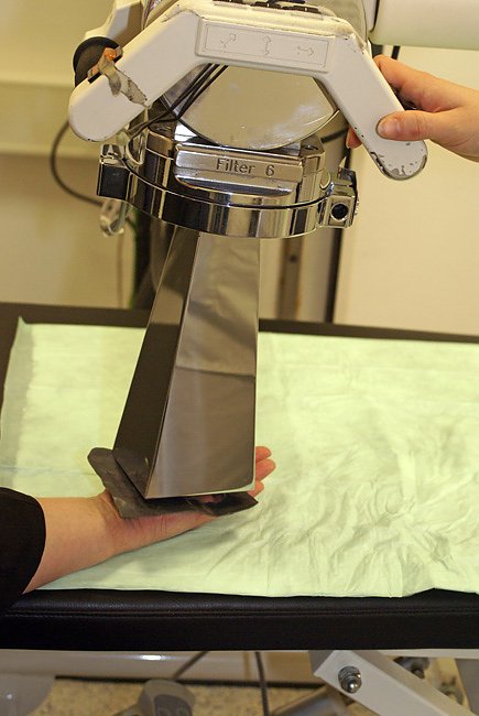 Bild - Handfl&auml;che Therapie (Foto: SHK)